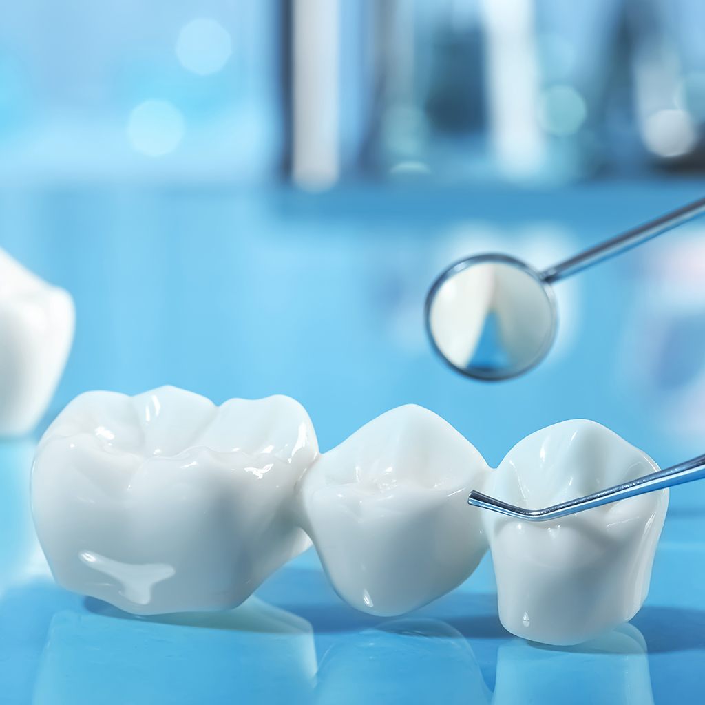 Dental Crowns and Bridges_479799356