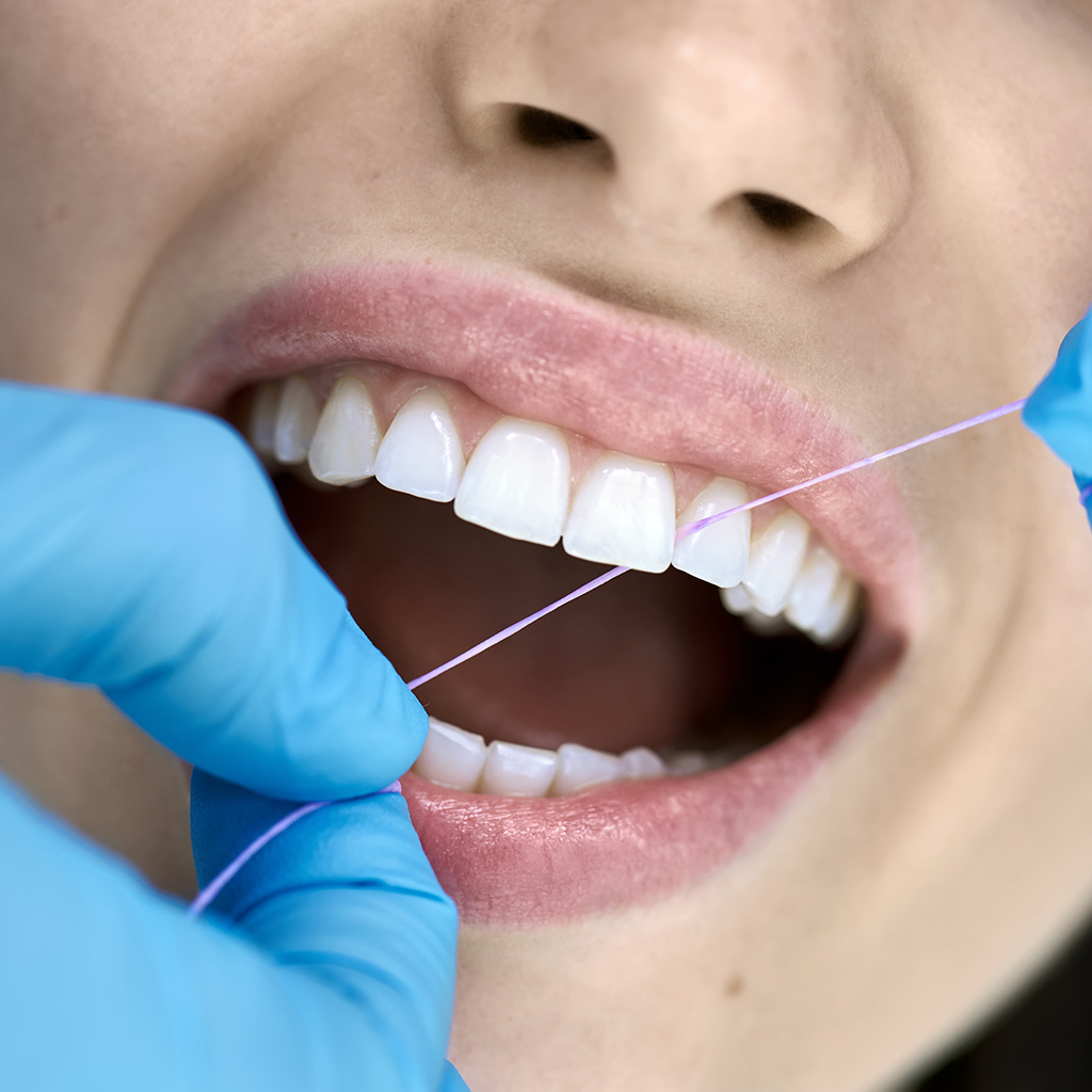 Dental Exams and Cleanings_298745998